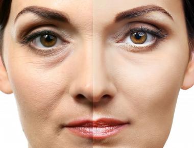 Anti-aging kezelés, 45+, érett, idősödő bőrre