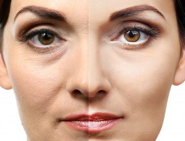Anti-aging kezelés, 45+, érett, idősödő bőrre